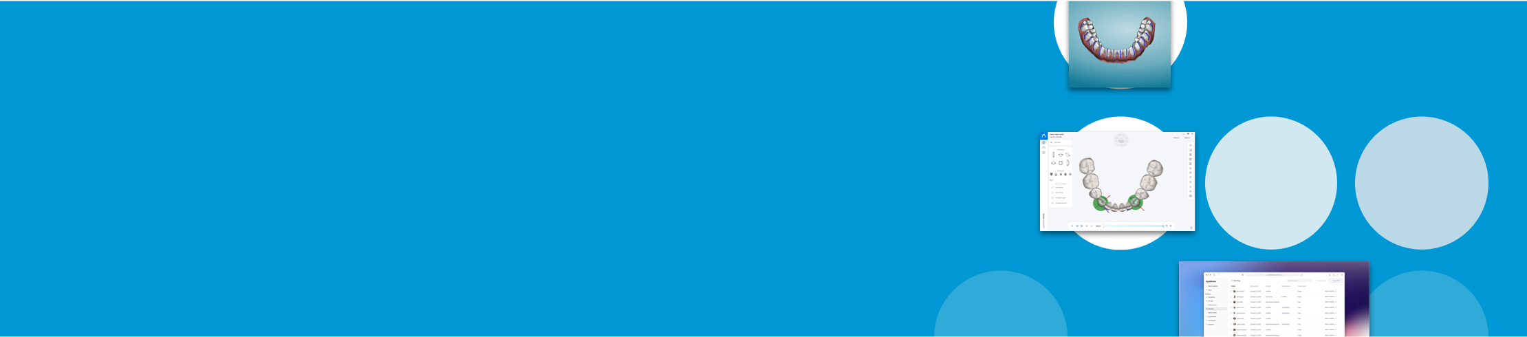 Tooth Movement Comparison